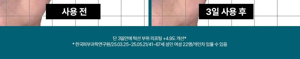 [휴닝카이PICK/피부볼륨] 더마펌 펩트올로지 부스팅 앰플 PDRN 30ml 기획 (+30ml 리필) 상세페이지 12